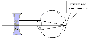 Корректировка зрения