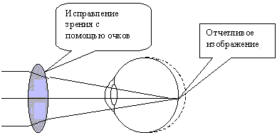Корректировка зрения